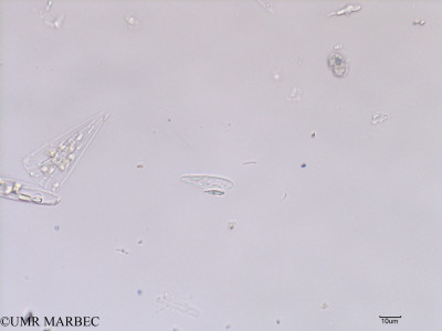 phyto/Scattered_Islands/iles_glorieuses/SIREME May 2016/Gomphonema sp2 (old Pennée spp 3-5x15-40µm -SIREME-Glorieuses2016-GLO5surf-191016-indeter3-1)(copy)_thumb.jpg